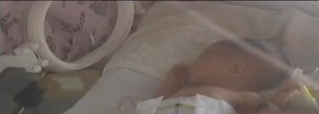 山东一产妇刚生孩子，一个月后又要临产，医生：从未见过这种情况