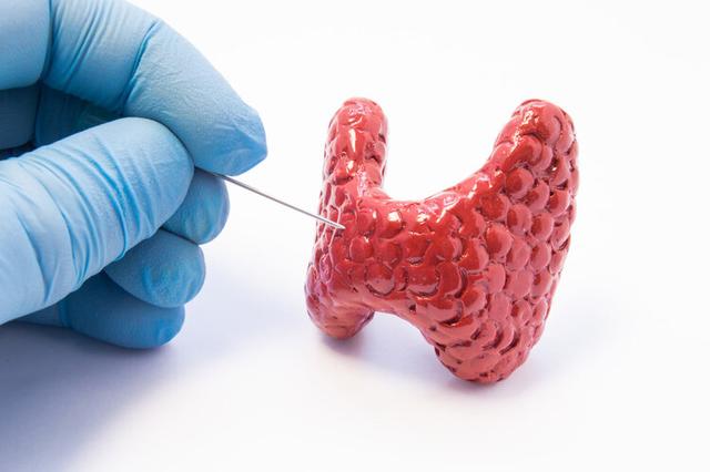 蘿卜是甲狀腺結節的“加速劑”？不想結節惡化，少吃2種食物