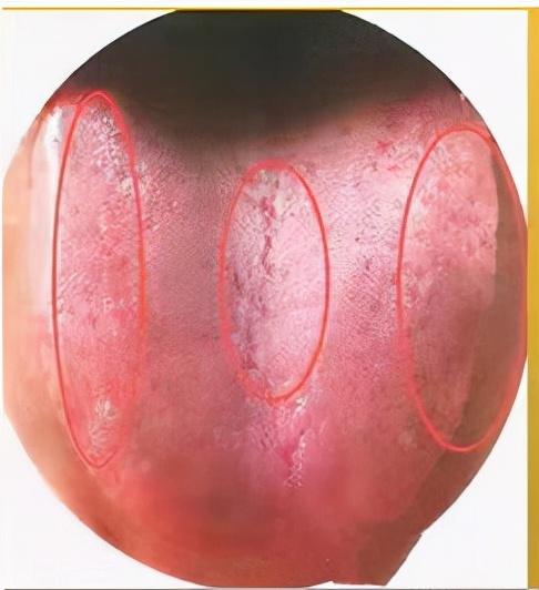 总爱生病，抵抗力差，中医教你3个方法，有效增强抵抗力