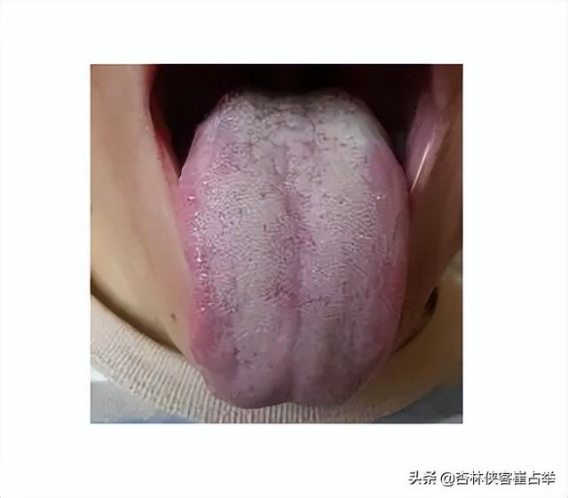 人长得不胖，肚子却很大，是脾虚吗？中医教你一个简单实用的方法