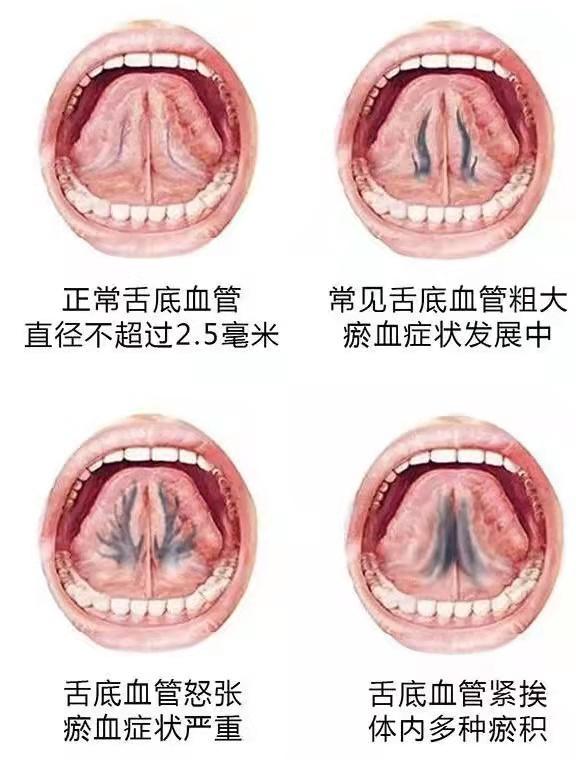 气血不足危害大，三个脏器最关键，教你三招，让你活力充沛