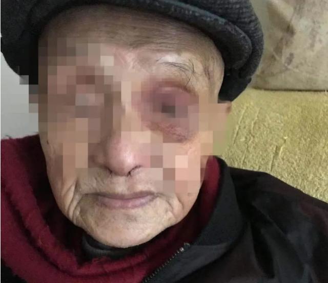 20年，成都95岁老中医告保姆：雇佣10年，我的百万存款咋成你的了