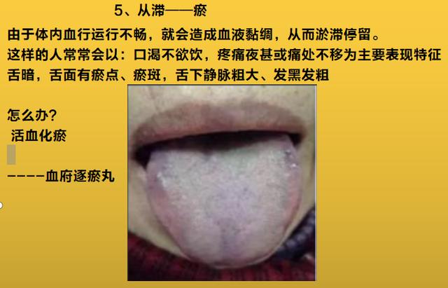 人体从虚-寒-湿-滞-瘀-瘤，仅仅经历了6个阶段，看看你在哪个阶段