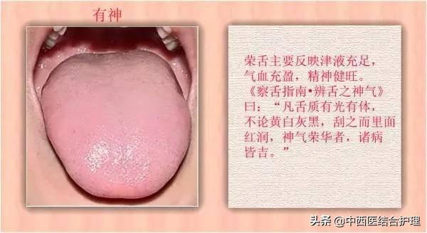 「舌诊科普」中医医生总看舌头都在看什么？奉上珍贵的舌诊图谱