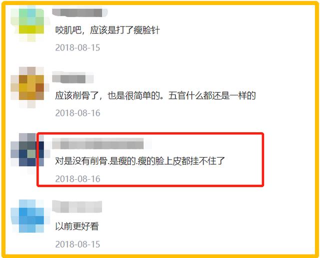 明星频翻车医美需谨慎！有人脸变充气气球，有人下巴变天气预报
