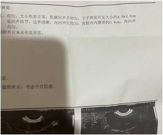 瘙痒，关节肿胀，乳腺肿痛，了解一味草药