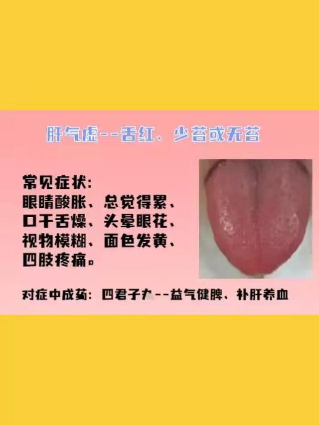身体常见的几种虚证，建议了解