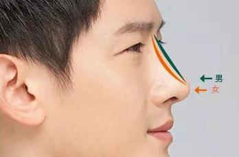 鼻头肥大怎么办