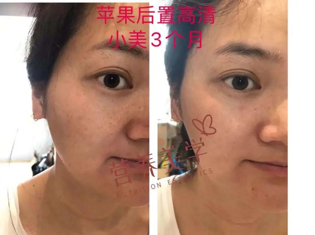 故事/二胎妈妈是如何找到自我的