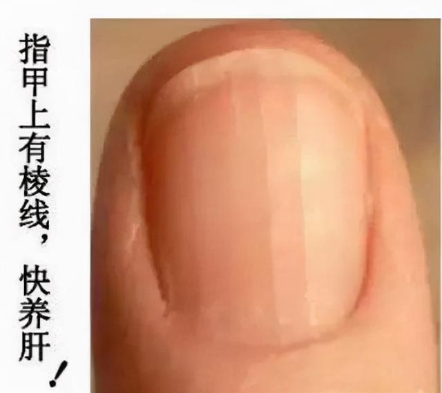 春季养肝正当时，读懂 肝脏发出的4个救命信号，早知道早健康