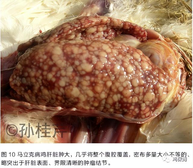 鸡皮肤是不传染