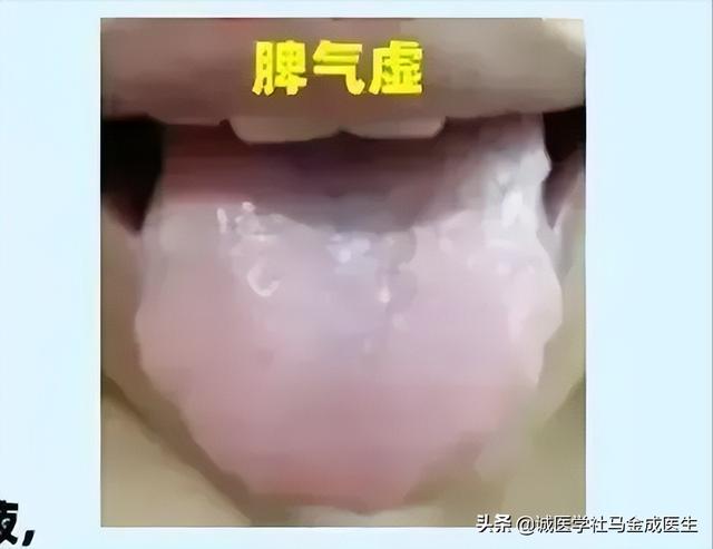 常用调理脾胃的中成药应用大全，不下十几种，看看怎么区分？