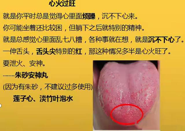 凌晨1—3点早醒，8种常见失眠类型，症状表现及实用中成药大总结
