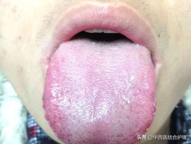 「舌诊科普」中医医生总看舌头都在看什么？奉上珍贵的舌诊图谱