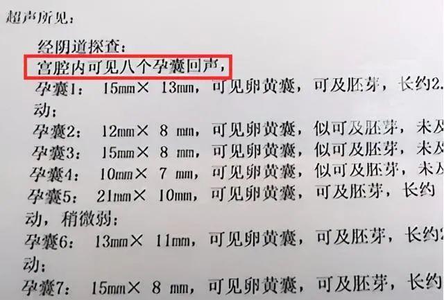 良医 | 18岁女子怀八胞胎？一胎到底能生几个孩子...…