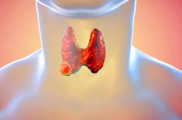 羊肉是甲状腺疾病的“发物”？提醒：除了羊肉，2种肉或要少碰