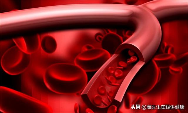 糖尿病病人应该是多喝水还是少喝水？