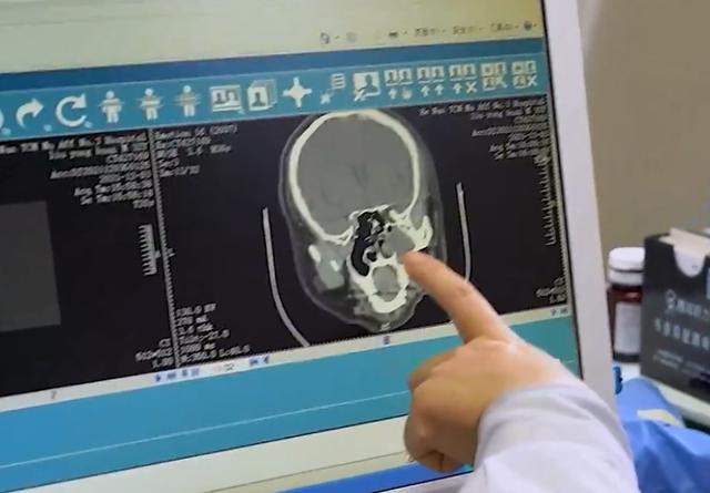 常见的鼻炎主要分2种，中医是如何调理的？先谈思路，再给方法