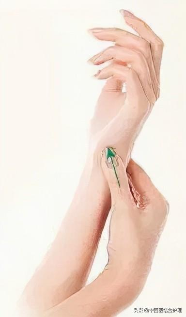 「穴位养生」它是皮肤发黄（黄疸）的特效穴，掐按3分钟，清热祛湿、利胁退黄