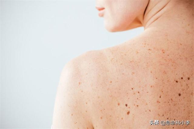 胳膊上好多小红点