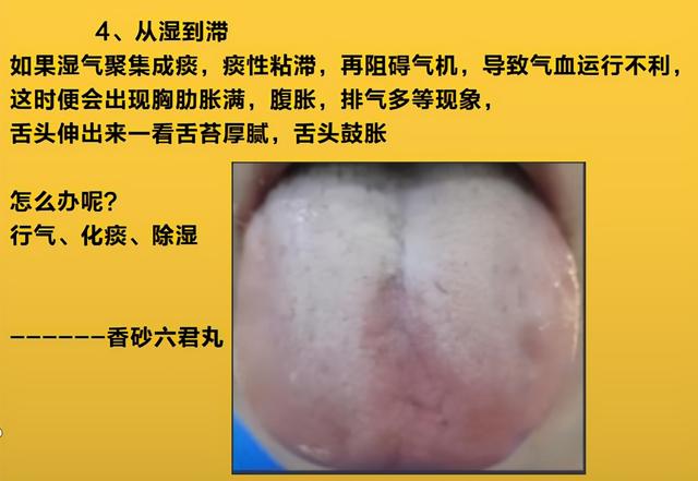 人体从虚-寒-湿-滞-瘀-瘤，仅仅经历了6个阶段，看看你在哪个阶段