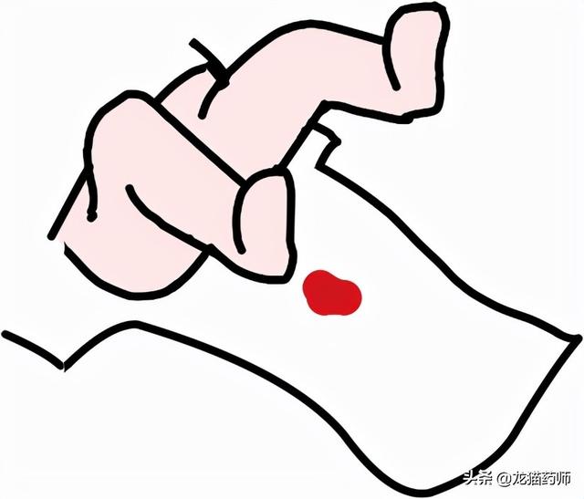 新生儿常见的生理现象