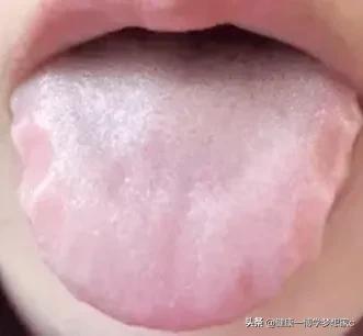 早起照镜子，你的舌头边上有没有齿痕，齿痕舌代表什么意思