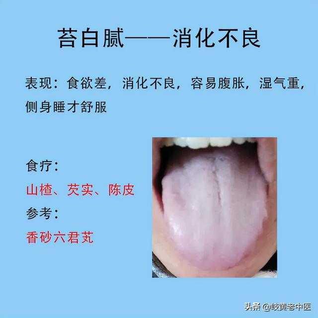 常见六种失眠的舌象，以及解决方法分享，这时候能睡个好觉了