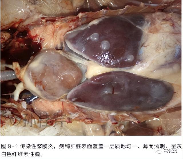 鸡皮肤是不传染