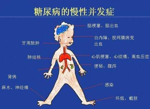 糖尿病人的“断舍离”