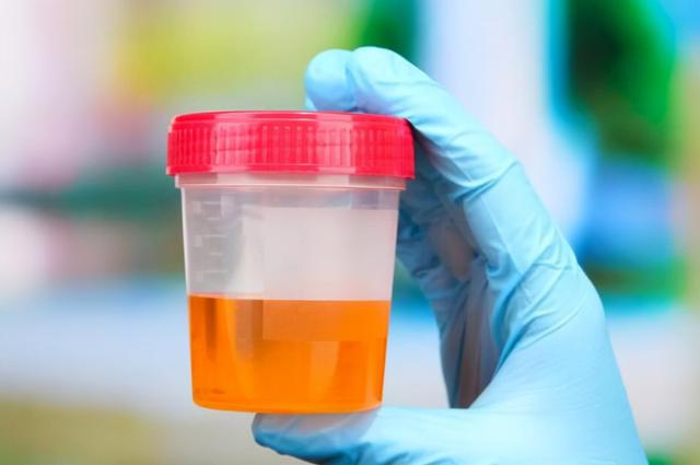 57岁大哥患脂肪肝，半年转氨酶从452降到39，看他是怎么做的？