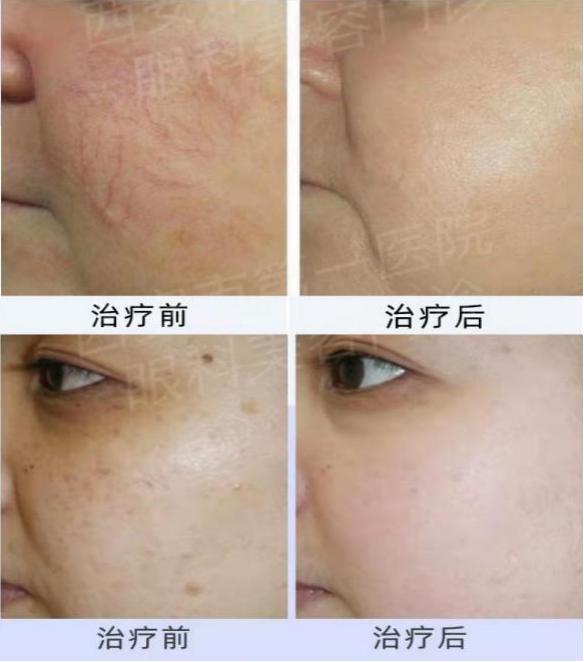 ������Ů���� �������˽ڡ�����Ů���ҽ���ڹ����ݡ�����������е�һҽԺ�ۿ�ҽ����������