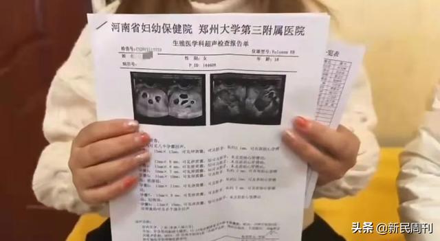 良医 | 18岁女子怀八胞胎？一胎到底能生几个孩子...…