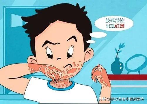 皮肤红肿很痒原因