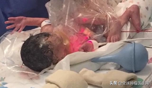 淚目！還未出生就確診癌癥，“傳奇”藥物讓最小的戰士擊敗腫瘤