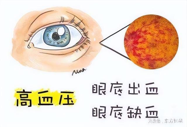 高血压难降，身体熬不住！教你降压五字诀，可以受益终身