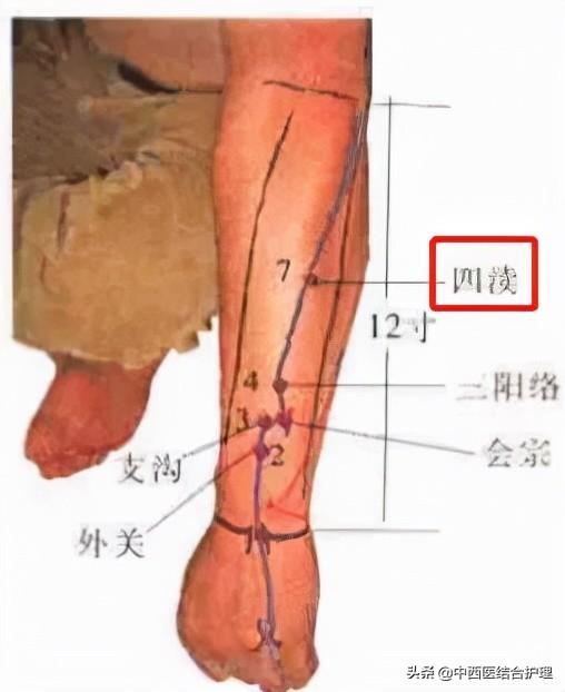 「慢性咽炎经络科普」刮刮四渎穴，也可调理咽喉痛