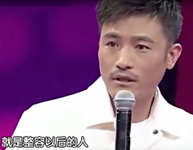 明星频翻车医美需谨慎！有人脸变充气气球，有人下巴变天气预报