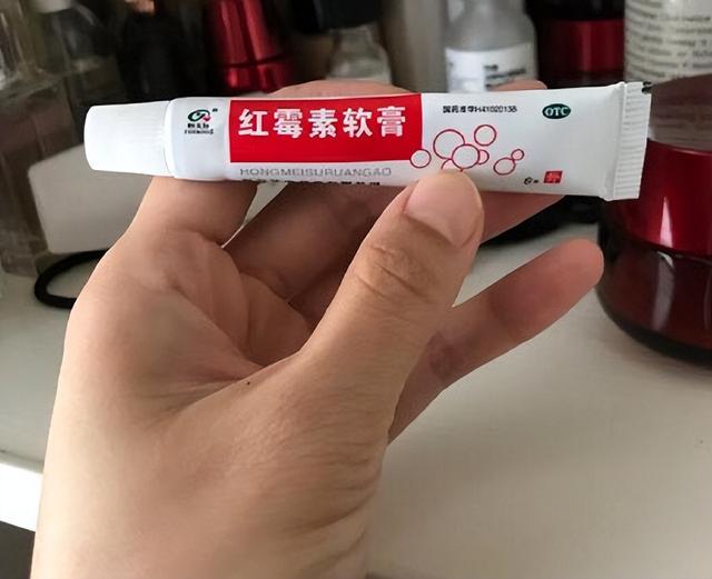 为什么会长老人斑？红霉素软膏能去除掉老人斑？医生：请尽早了解