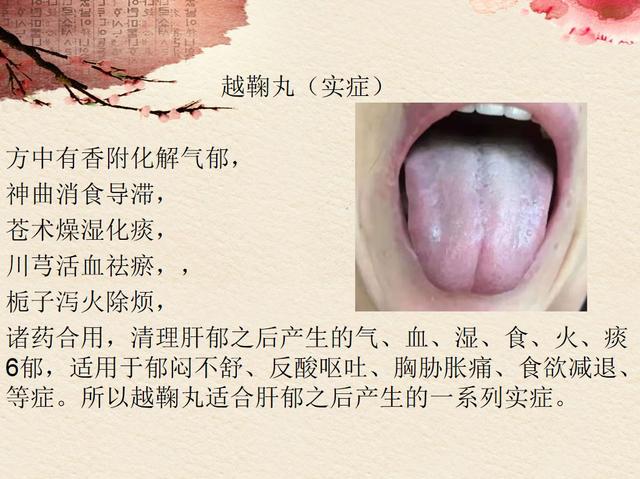 逍遥丸、柴胡舒肝丸、越鞠丸如何通过舌像选？春季养肝秘诀在这里