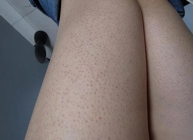 维a涂鸡皮肤怎么用