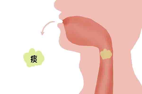 黄痰、白痰、黑痰、血性痰，分别提示什么健康问题？痰多咋办？