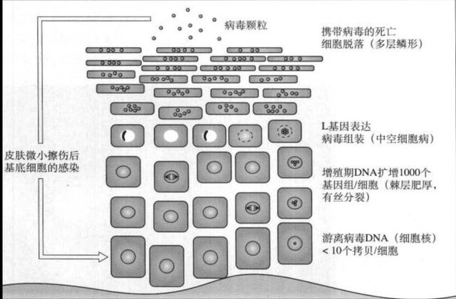 跖疣怎么办