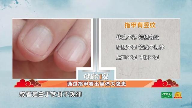 手指甲满足3个特点，多半是身体在“求救”！赶紧自测