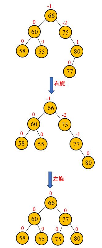 数据结构——平衡二叉树