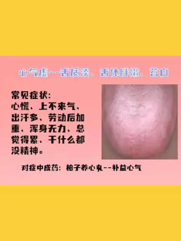 身体常见的几种虚证，建议了解
