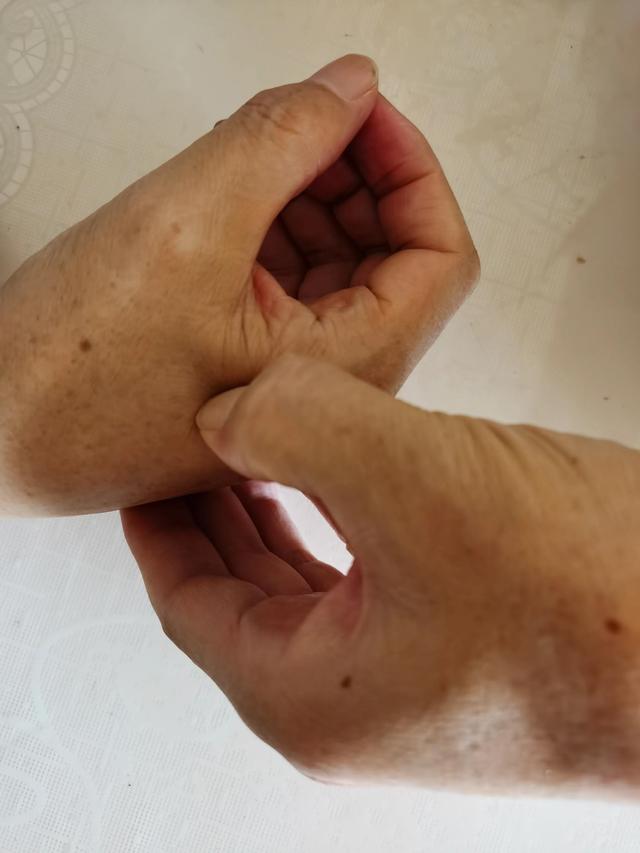 可以自我操作的第二掌骨桡侧诊疗法