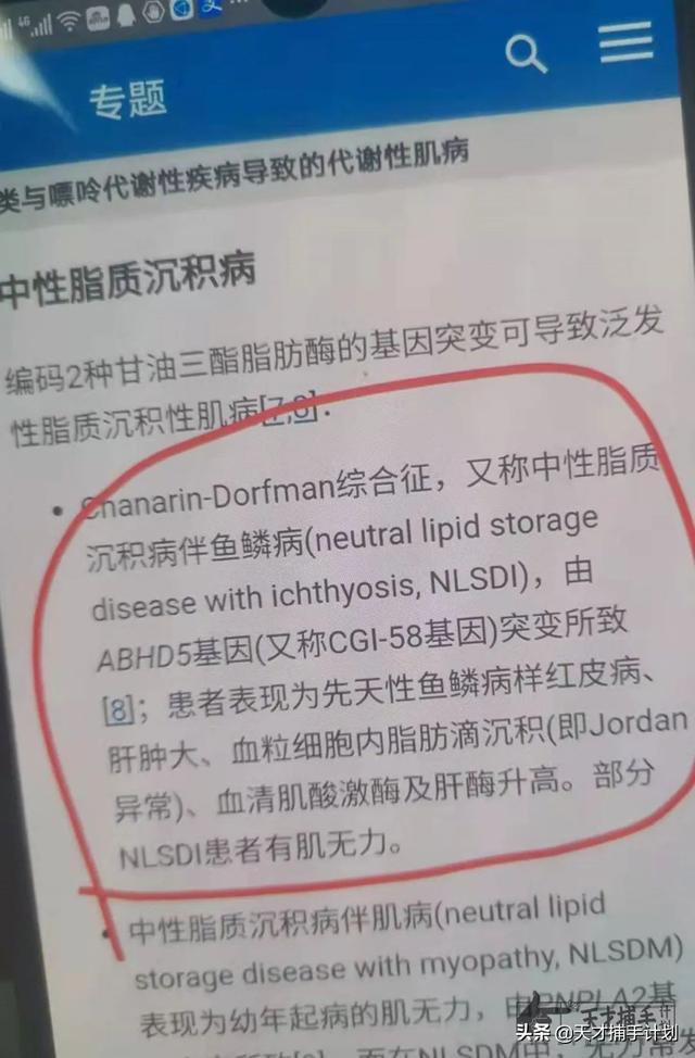 盖住鱼鳞病的身体乳