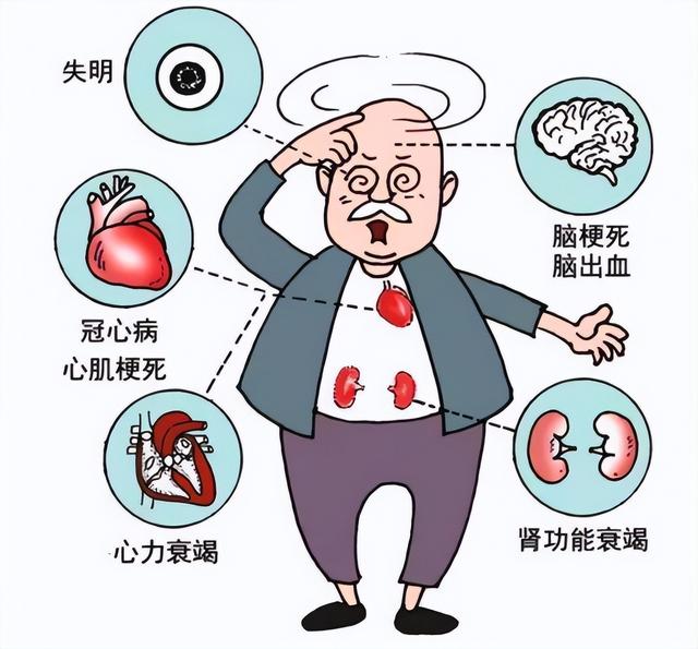 3种降压药不要长期服用，很多患者还在吃，医生建议及时换药