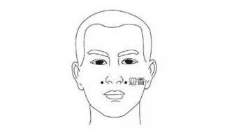 迎香穴治疗鼻塞